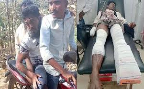 নাইক্ষ্যংছড়ি সীমান্তে বানর তাড়াতে গিয়ে মাইন বিস্ফোরণে পা হারালেন কৃষক