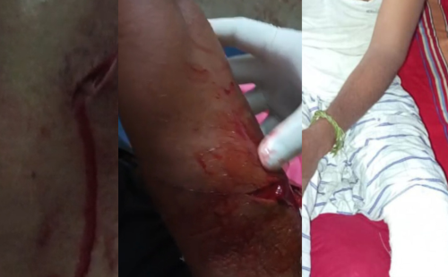 কুষ্টিয়ার হার্ডিঞ্জ ব্রিজ এলাকায় সন্ত্রাসী হামলা: আহত একাধিক মাঝি-মাল্লা ও পর্যটক, প্রশাসনের নীরবতা